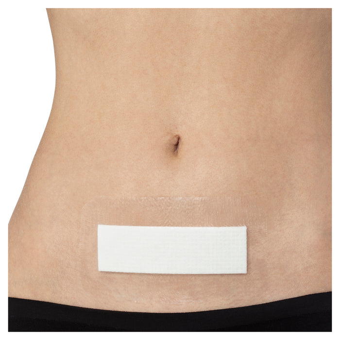 Opsite Post-Op Waterproof Dressing 15.5cm x 8.5cm Single.
