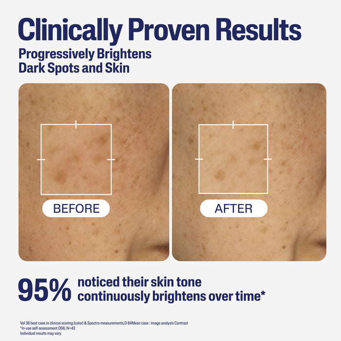 Cetaphil Bright Healtthy Radiance 30ml