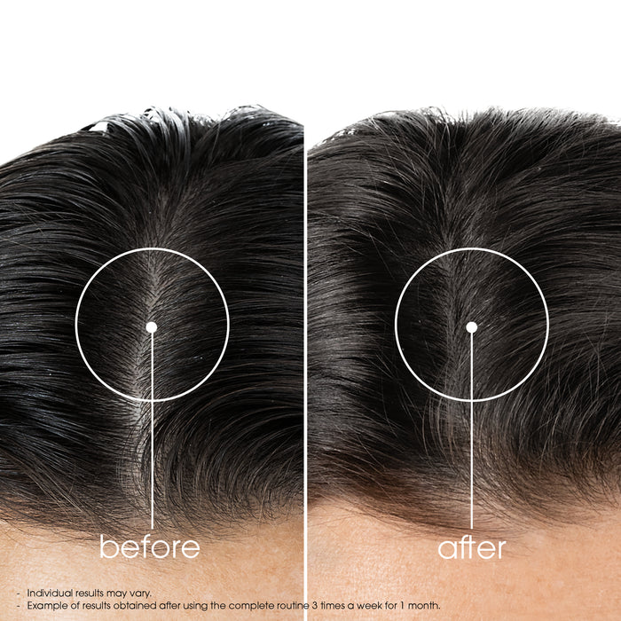 Klorane Quinine & Organic Eldelweiss Conditioner 200ml.