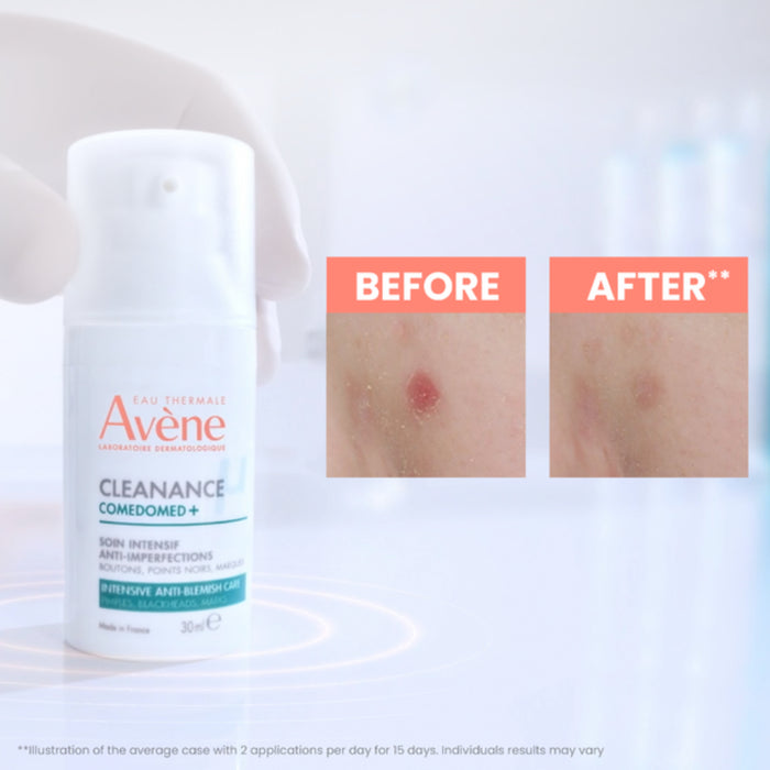 Avene Cleanance Comedomed 30ml