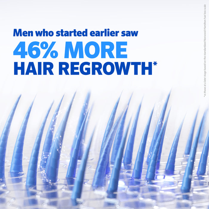 Regaine Solution Hair Loss Treatment Mens Extra Strength Topical Application 4 x 60mL