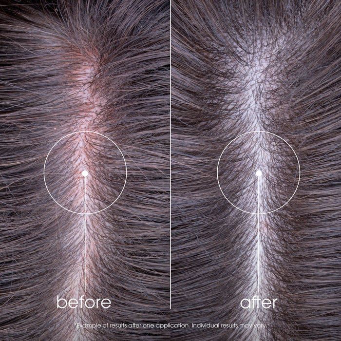 Klorane Peony SOS Serum 100ml.