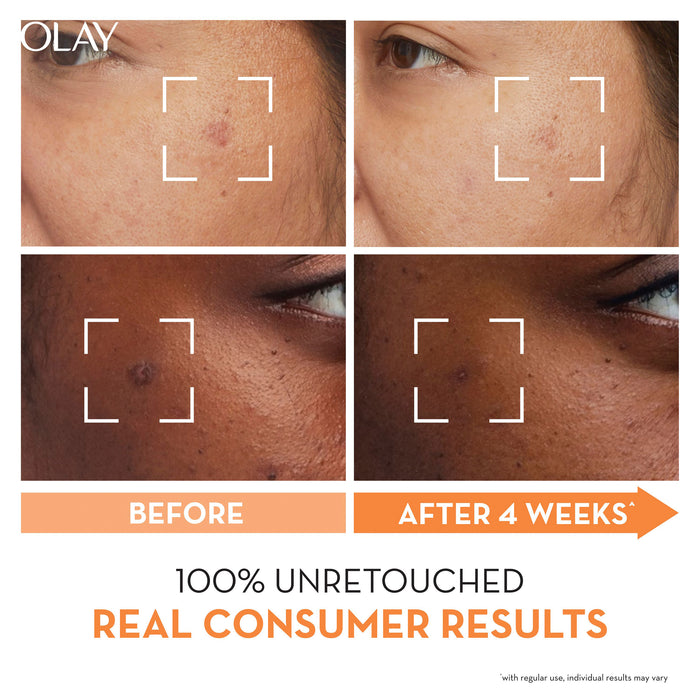 Olay Luminous Niacinamide + Vitamin C Moisturiser 50g