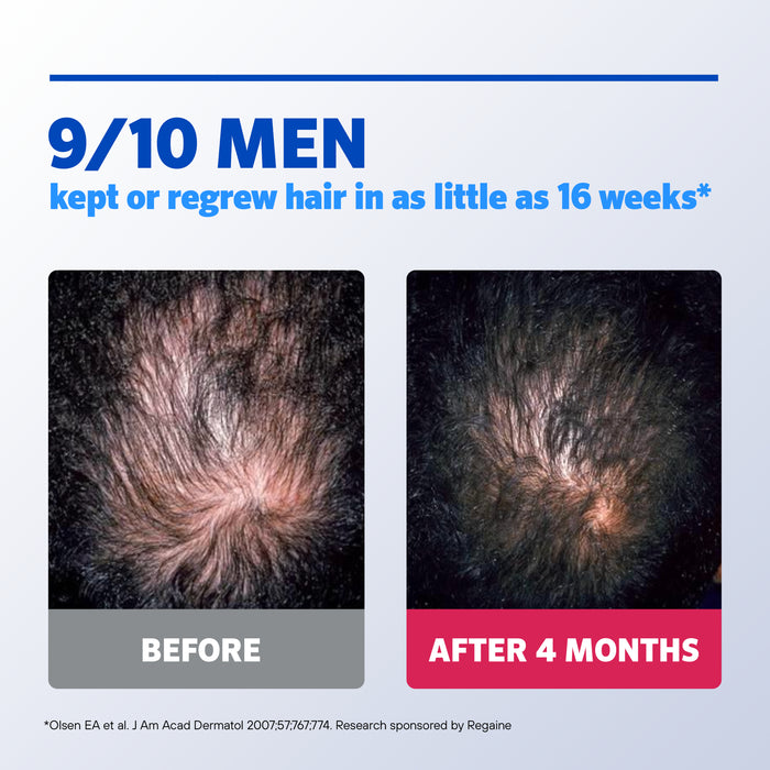 Regaine Solution Hair Loss Treatment Mens Extra Strength Topical Application 4 x 60mL