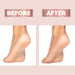 Finishing Touch Flawless Pedi Tool.
