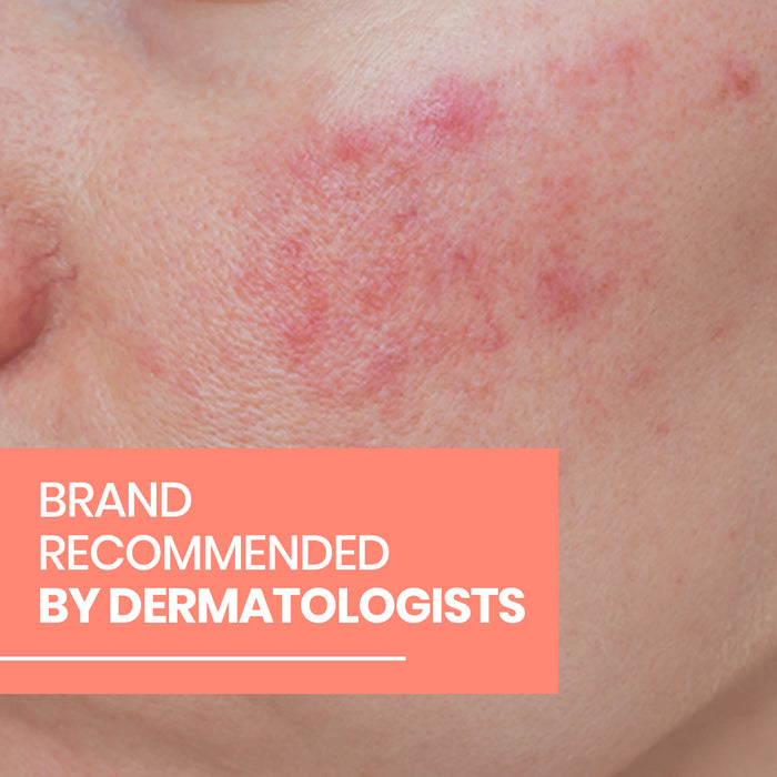 Avene Redness Expert Soothing Moisturising Concentrate 30ml.