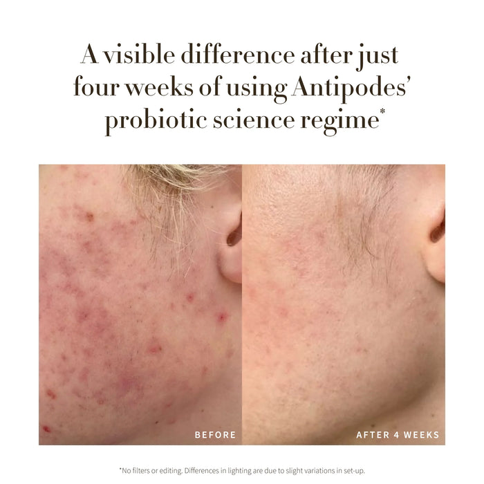 Credo Probiotic Anti-Blemish Serum 30ml Short Dated