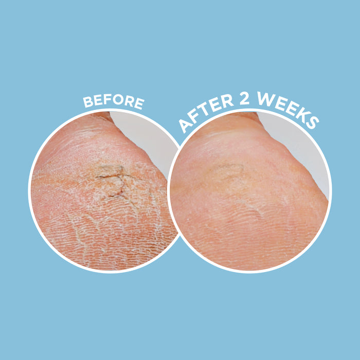 Dermal Therapy Heel Magic 70g