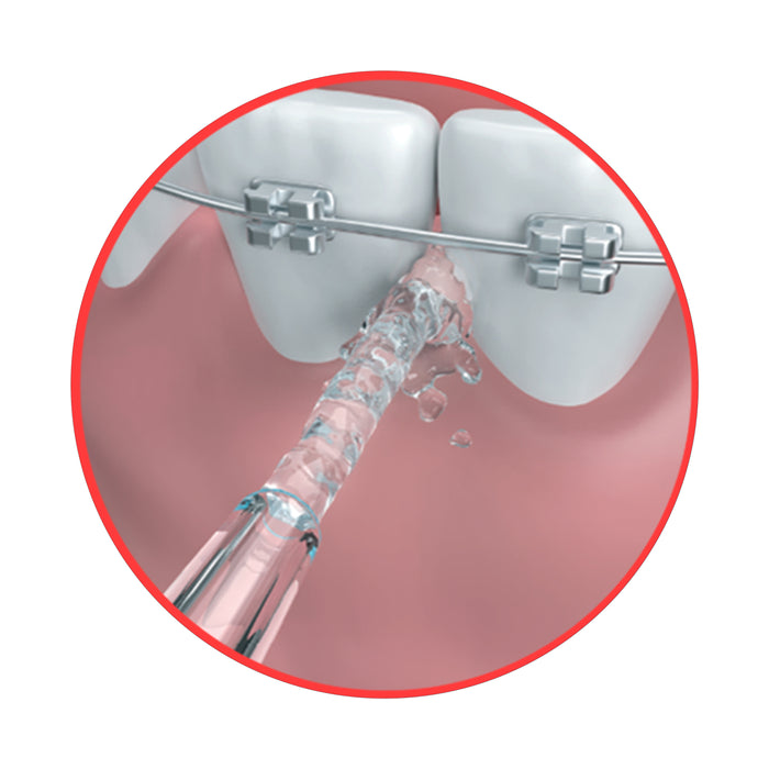 GO2 Dentagenie Water Flosser