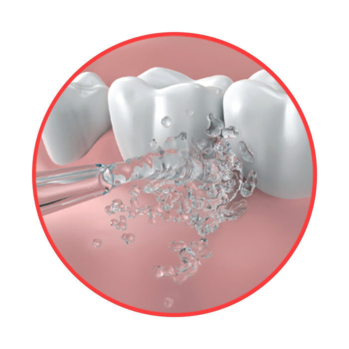 GO2 Dentagenie Water Flosser
