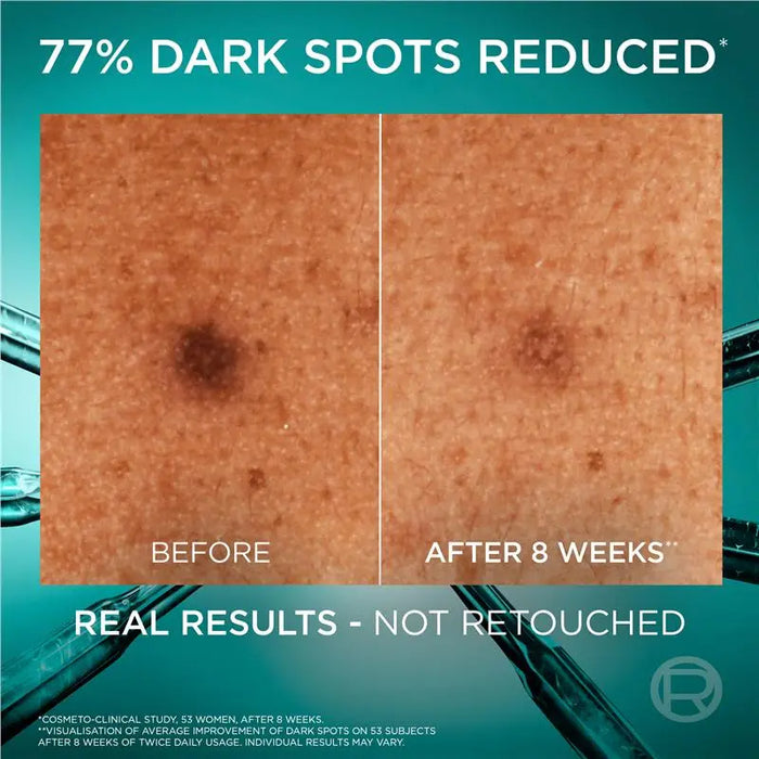 L'Oreal Paris Revitalift Bright Reveal Dark Spot Serum 30ml