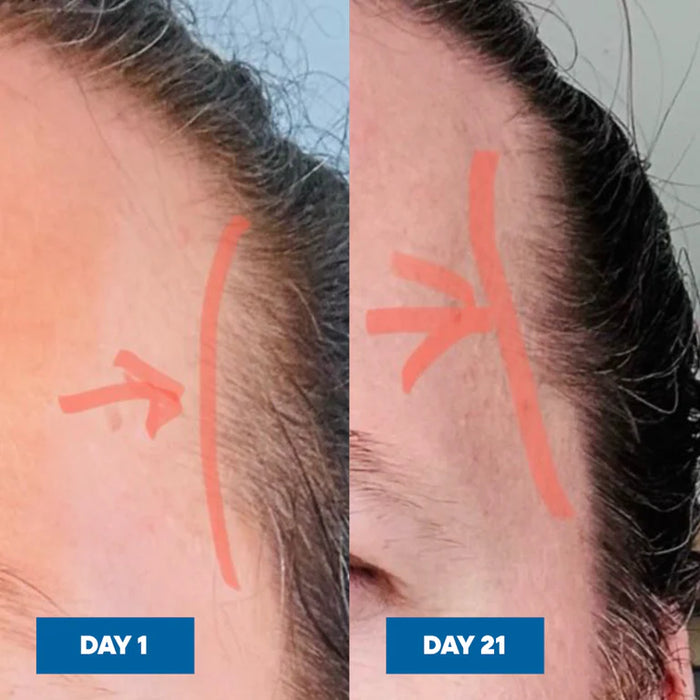 MooGoo Hair Growth Serum 30ml