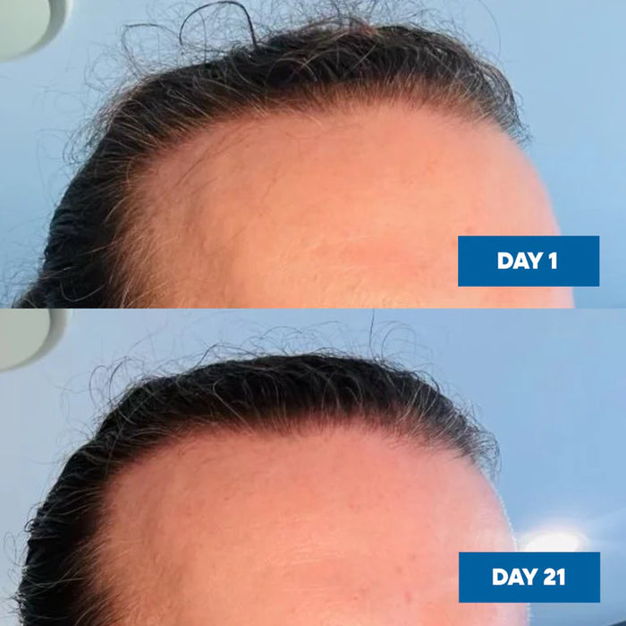 MooGoo Hair Growth Serum 30ml