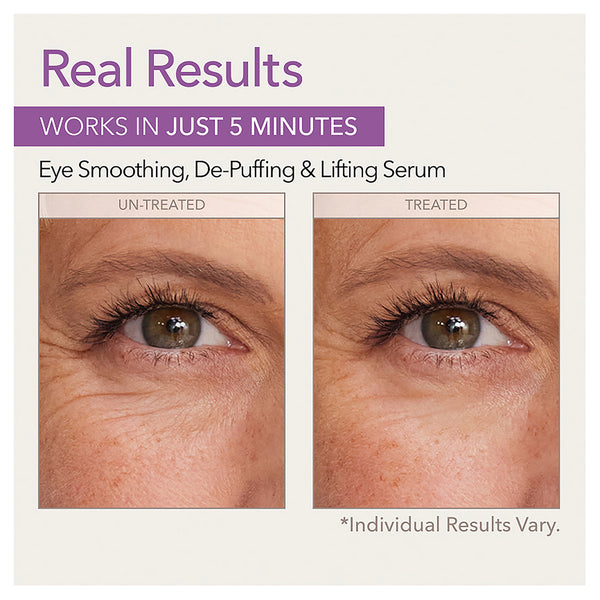 Skin Doctors Instant Eye Lift 10ml