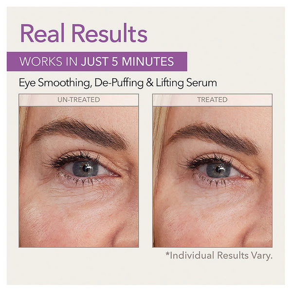 Skin Doctors Instant Eye Lift 10ml