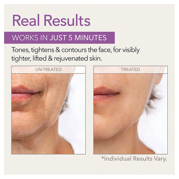 Skin Doctors Instant Facelift 30ml