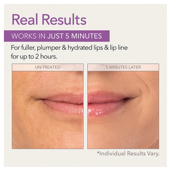 Skin Doctors Instant Lip Plumper 3ml