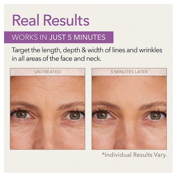 Skin Doctors Instant Wrinkle Filler 10ml