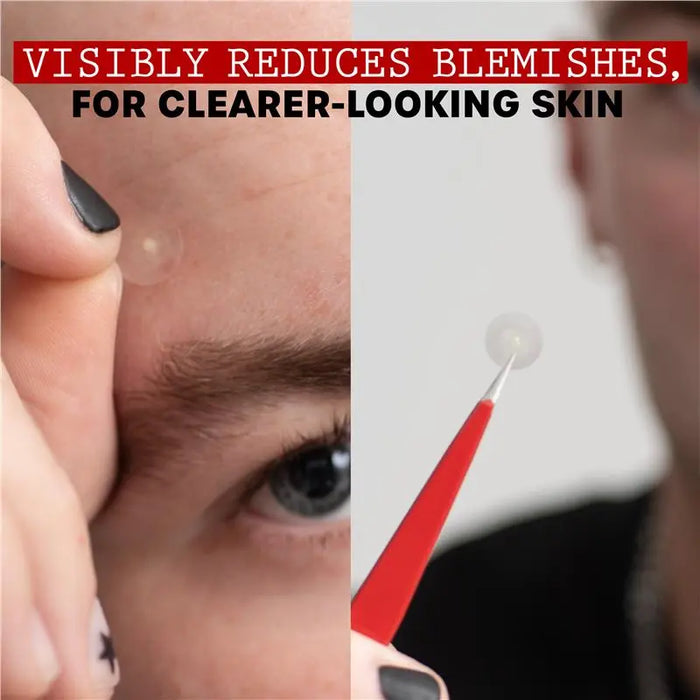 Thayers Invisible SOS Patch 22pk