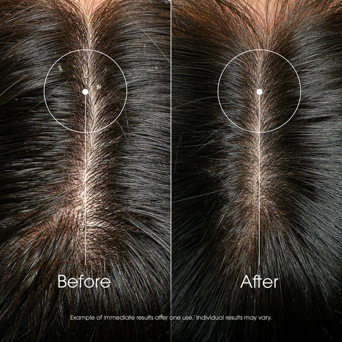 Klorane Anti-Dandruff Rebalancing & Treating Shampoo With Galangal 400ml