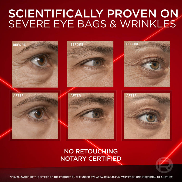 LÓreal Revitalift Laser Eye Bag Instant Eraser 15ml