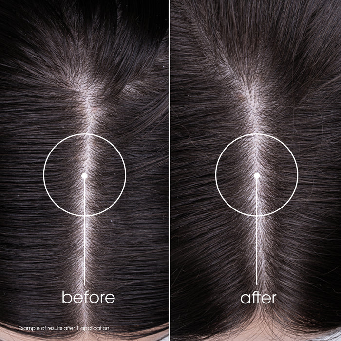 Klorane Nettle Shampoo 400ml.