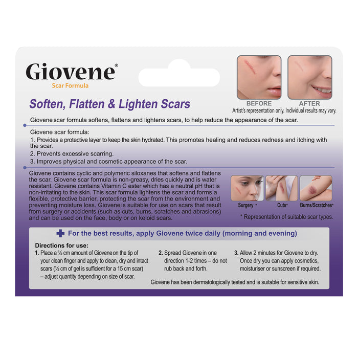 Giovene Scar Gel 15g