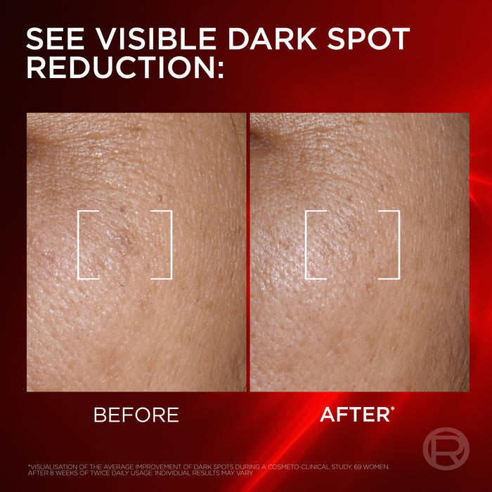L'Oreal Revitalift Triple Laser 50ml