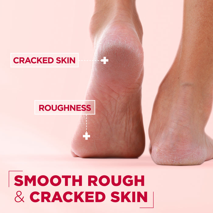 Mixa Cica Ointment 150ml